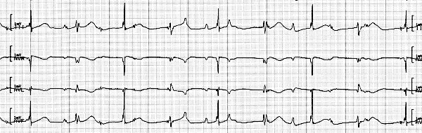 strip 113L
