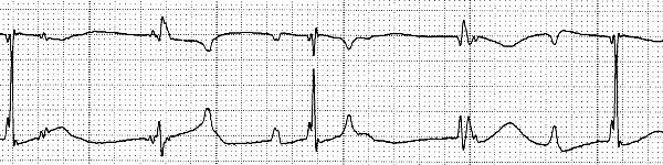 strip 113M